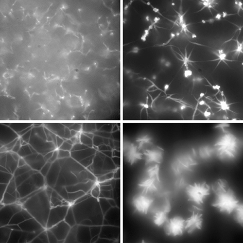 Beispiele gebündelter, Stern-ähnlicher, vernetzter und kompakter Micropartikelstrukturen, die aus DNA-Röhren geformt wurden. (von New J. Phys. 18 (5), 055001)