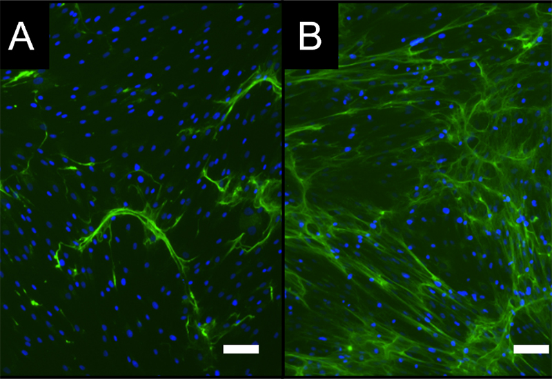 Färbung der durch humane mesenchymale Stammzellen gebildeten extrazellulären Matrix (grün) ohne (A) und mit inflammatorischem Einfluss (B). Messbalken 100 µm.