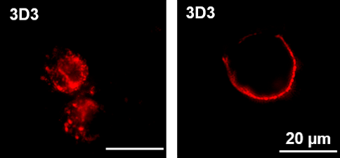 Die fluoreszenzmikroskopischen Aufnahmen transfizierter HEK293F­Zellen mit dem HERV-Fc1 Env- spezifischen Antikörper 3D3 (rot) zeigen das Vorkommen des Hüllproteins im Zell-inneren bei permeabilisierten Zellen (links) sowie auf der Zelloberfläche bei Zellen mit intakter Zellmembran (rechts).