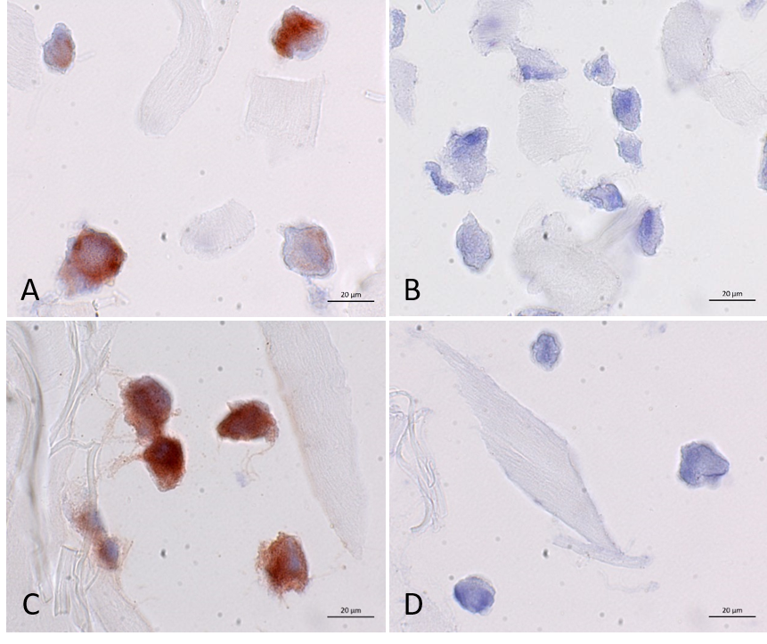 Methodenvalidierung der immunhistochemischen HLA-ABC-Färbung an mesenchymalen Stammzellen der humanen Nabelschnur (hUC-MSCs). Spezifische und sensitive, rötlich-braune Färbung von nicht-expandierten (A) und expandierten (C) hUC-MSCs mit dem monoklonalen Antikörper gegen humane MHC-Klasse-I-Antigene (Klon W6/32, Fa. Agilent) und einer Hämatoxylin-Kerngegenfärbung. Für die Negativkontrolle  wurde der Isotypkontrollantikörper (Klon: DAK-G05, Fa. DAKO)  verwendet (B und D). Zwischen den hUC-MSCs sind die ungefärbten Kollagenfasern der Chondro-Gide®-Matrix erkennbar (A-D).