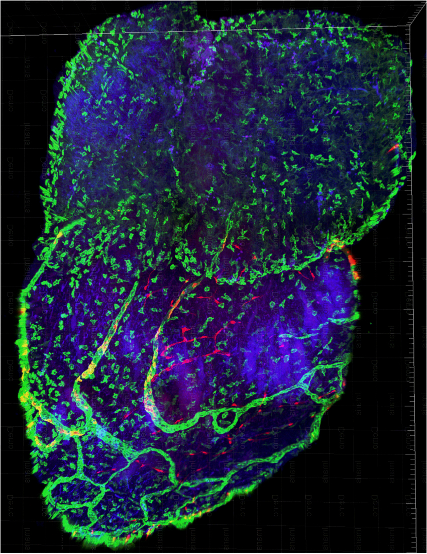 Das Herz einer neugeborenen Maus zum Zeitpunkt an dem es noch regenerationsfähig ist. Das Bild zeigt Zellen des Immunsystems und der koronaren Gefäßversorgung, die beide für die Herzregeneration relevant sind.