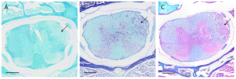 Serial coronal sections of the thoracic spinal cord from a mouse with a clinical score of 2.25. A: Luxol Fast Blue (LFB) stain. B: LFB + cresyl violet stain. C: LFB + hematoxylin and eosin stain. Blue = myelin, violet = cell nuclei, pink = cytoplasm. Arrow: demyelination in the white matter and infiltration of cells. Magnification: 10x. Scale bar: 300 µm.