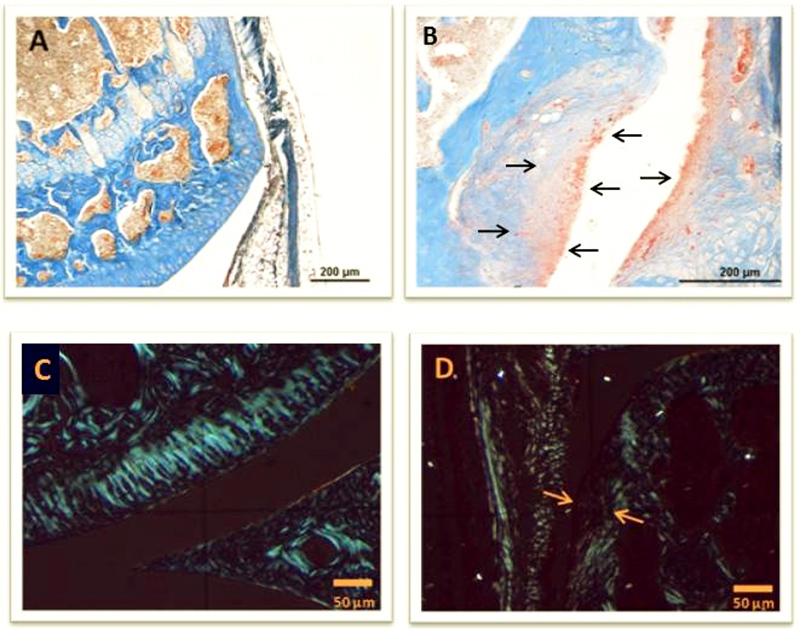 Histological changes in knee joints of Balb/c mice after transplantation of invasive fibroblasts. A: Healthy joint of a Balb/c mouse. KAO stained. B: Signs of destruction in a knee joint of a Balb/c mouse 4 weeks after transplantation of fibroblasts. KAO stained. C: Healthy joint of a Balb/c mouse in polarization microscope. D: Signs of destruction in a knee joint of a Balb/c mouse 4 weeks after transplantation of fibroblasts seen by polarization microscopy.