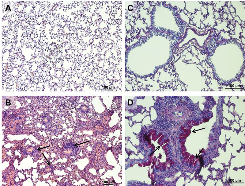 Airway remodelling in acute HDM induced allergic asthma in mice. A: Healthy lung tissue (HE stain). B: Fibrotic lung tissue of an allergic mouse. Besides fibrosis infiltration of eosinophils is clearly visible (arrows). C: Healthy lung tissue (PAS stain). D: Goblet cell hyperplasia and airway narrowing (arrows) in the lung of a mouse with acute HDM induced allergic asthma.
