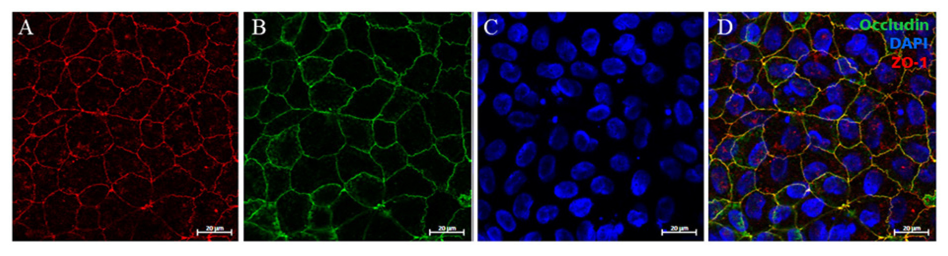 Indirect immunofluorescence staining of tight junction proteins from untreated Caco-2 cells