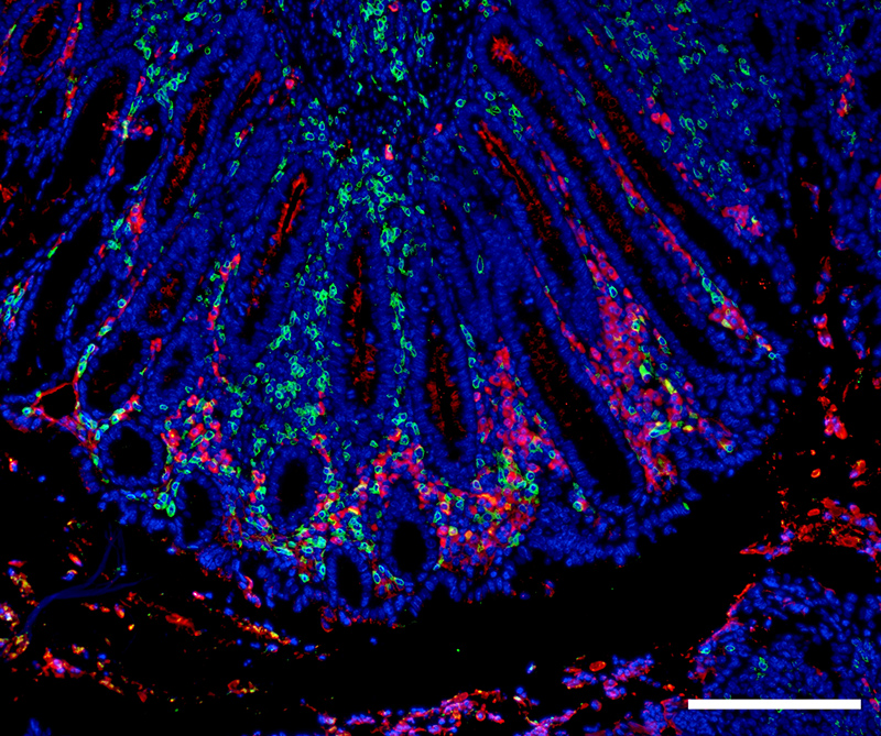 Expression of Immunoglobulin A (red) and T helper cells (CD4; green) in the distal colon of an animal with chronic DSS-induced colitis. Scale bar: 100 µm