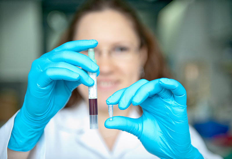 Sample preparation
