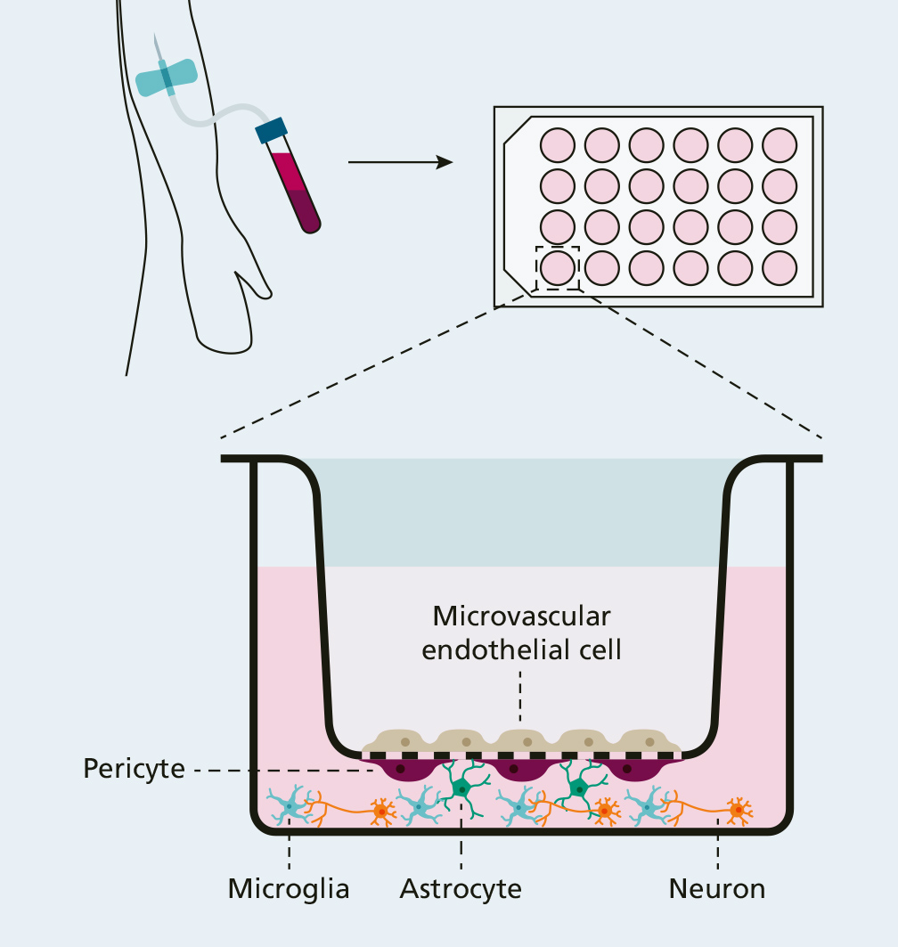 disease model of the blood-brain barrier
