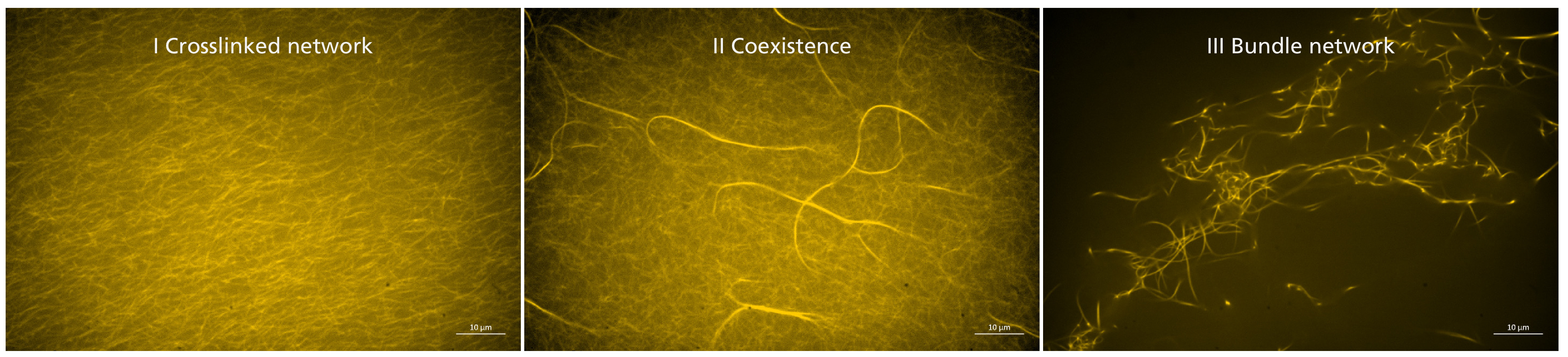 Synthetic crosslinkers influence the elasticity of actin networks. This behavior can be attributed to different structural morphologies within the network. Fluorescence microscopy.
