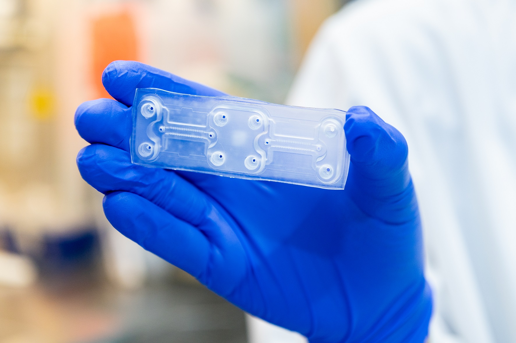The aim of her medical doctorate is to develop an organ-on-a-chip model that can be used to image and study the pathologically altered bone marrow in AML. Close-up chip held in a gloved hand.
