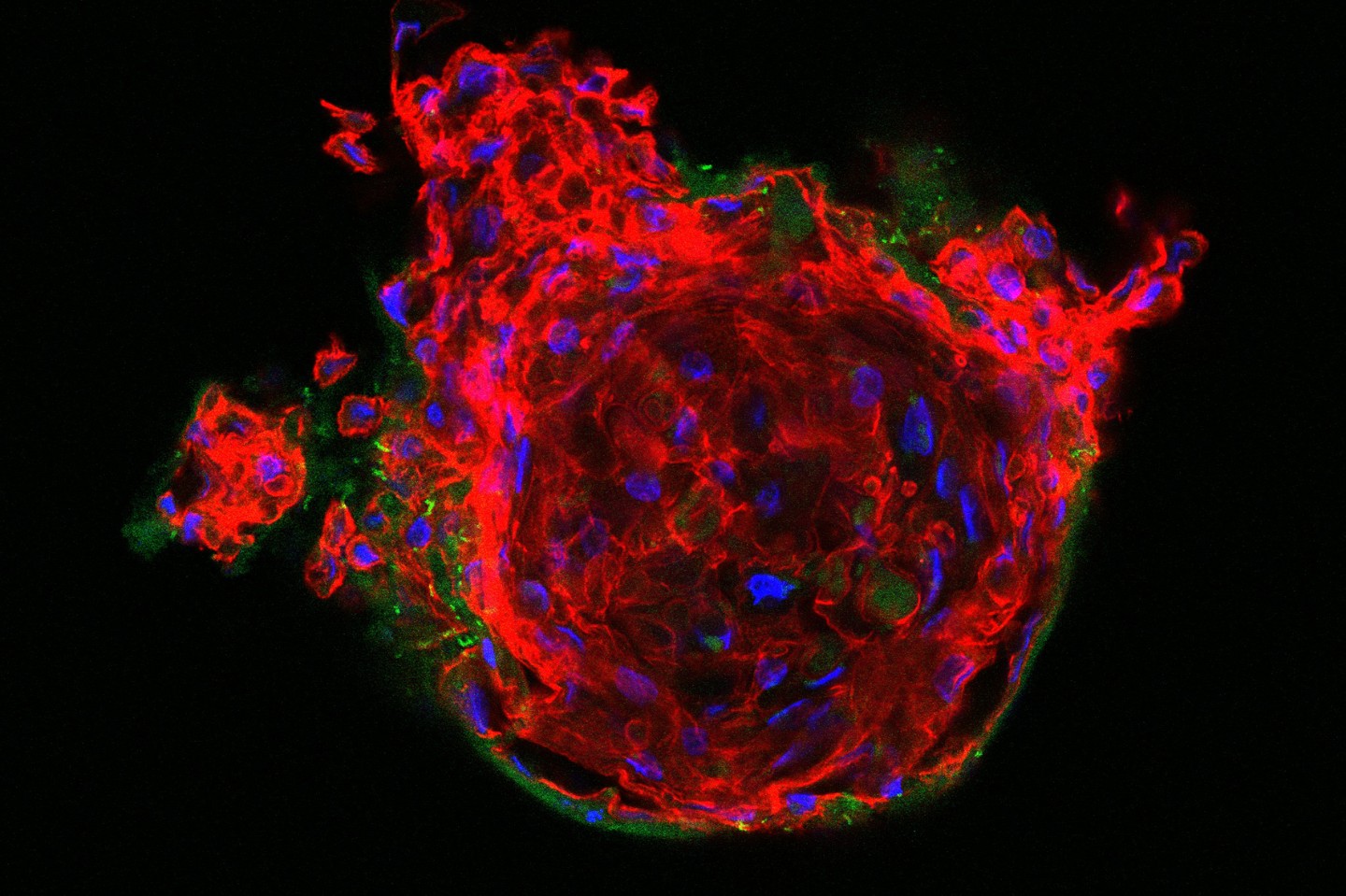 3D cell cultures such as this fixed human epithelial organoid should in future be investigable with live imaging in order to visualize cellular processes. 3D cell cultures such as this fixed human epithelial organoid should in future be investigable with live imaging in order to visualize cellular processes.
