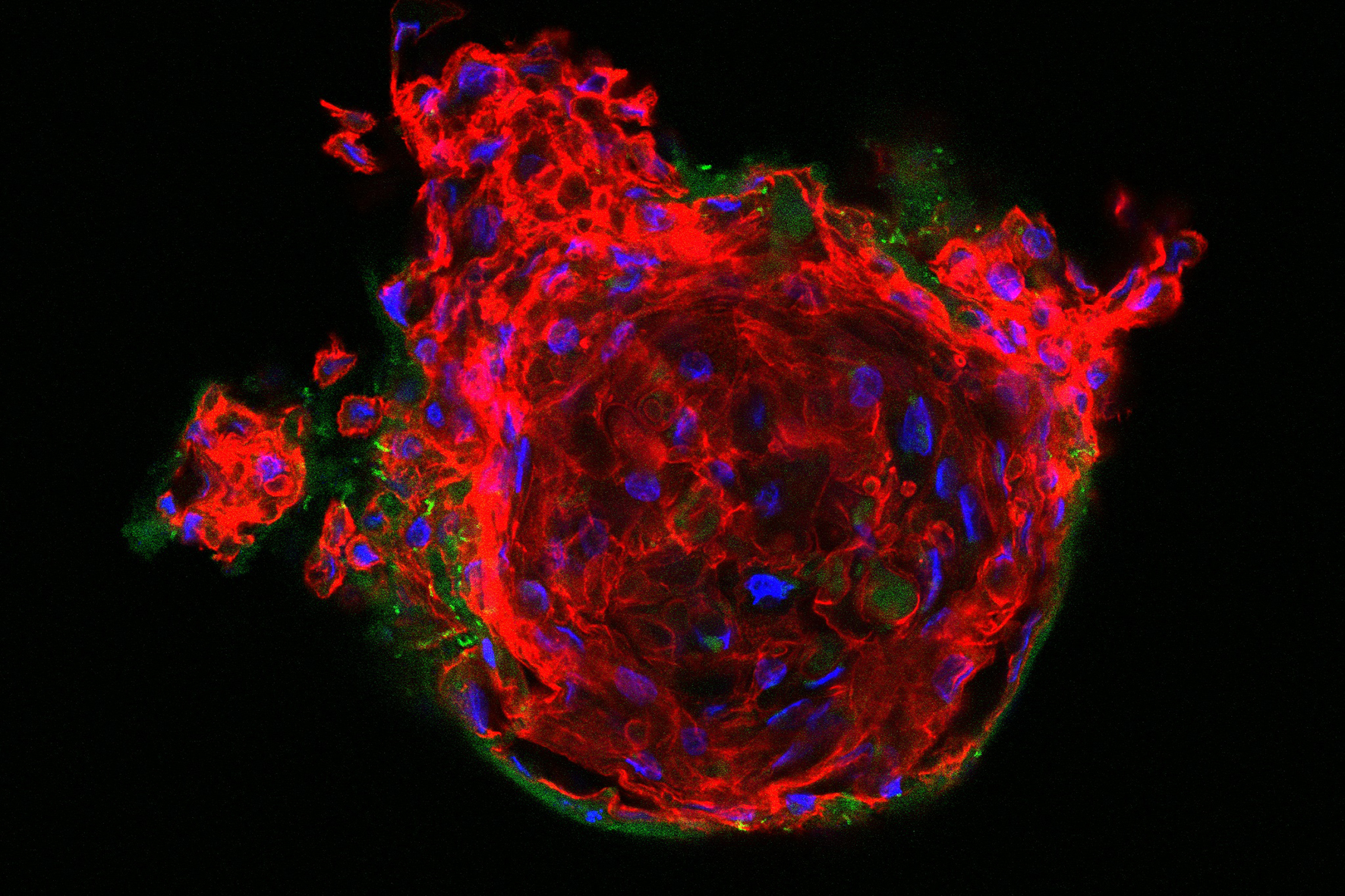 3D cell cultures such as this fixed human epithelial organoid should in future be investigable with live imaging in order to visualize cellular processes. 3D cell cultures such as this fixed human epithelial organoid should in future be investigable with live imaging in order to visualize cellular processes.
