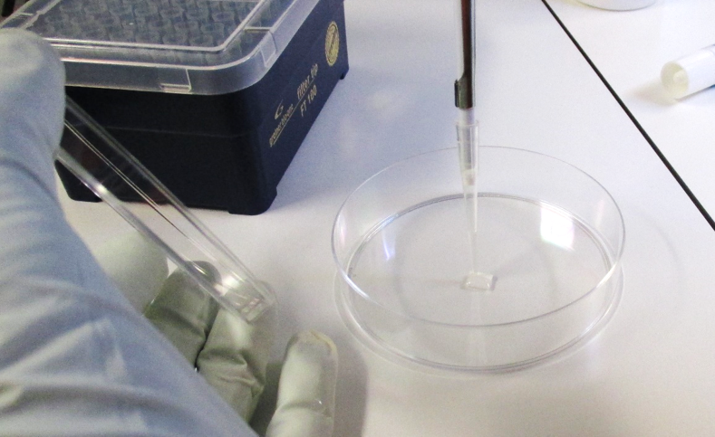 Application of human umbilical cord mesenchymal stem cells (hUC-MSC's) onto a collagen matrix (Chondro-Gide®) Application of human umbilical cord mesenchymal stem cells (hUC-MSC's) onto a collagen matrix (Chondro-Gide®)